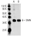 SMN (2B1): sc-32313. Western blot analysis of SMN expression in HeLa (A) and Jurkat (B) nuclear extracts.