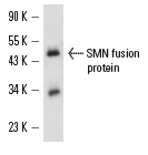 SMN (2B1): sc-32313. Western blot analysis of human recombinant SMN fusion protein.