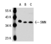 SMN (2B1): sc-32313. Western blot analysis of SMN expression in 293 (A), HeLa (B) and Jurkat (C) whole cell lysates.