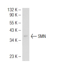 SMN (2B1): sc-32313. Western blot analysis of SMN expression in 293T whole cell lysate.