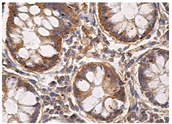 SMN (2B1): sc-32313. Immunoperoxidase staining of formalin fixed, paraffin-embedded human colon tissue showing cytoplasmic staining of glandular cells.