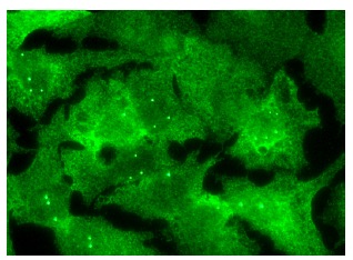 SMN (H-195): sc-15320. Immunofluorescence staining of formalin-fixed Hep G2 cells showing cytoplasmic and nuclear localization.