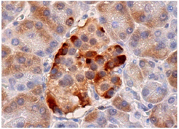 UCH-L1 (H-40): sc-25800. Immunoperoxidase staining of formalin fixed, paraffin-embedded human pancreas tissue showing cytoplasmic staining of Islets of Langerhans and glandular cells.