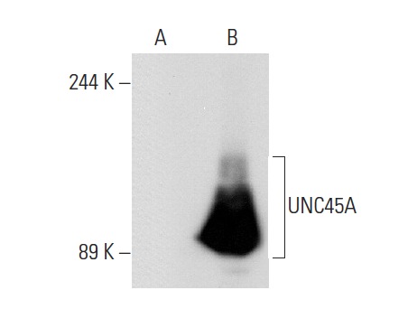 UNC45A (AbS1): sc-101493. Western blot analysis of UNC45A expression in non-transfected: sc-117752 (A) and human UNC45A transfected: sc-175029 (B) 293T whole cell lysates.