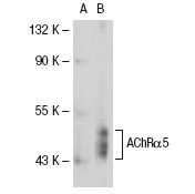 AChRα5 (268): sc-58606. Western blot analysis of AChRα5 expression in non-transfected: sc-117752 (A) and human AChRα5 transfected: sc-115226 (B) 293T whole cell lysates.