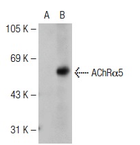 AChRα5 (268): sc-58606. Western blot analysis of AChRα5 expression in non-transfected: sc-110760 (A) and human AChRα5 transfected: sc-158228 (B) 293 whole cell lysates.