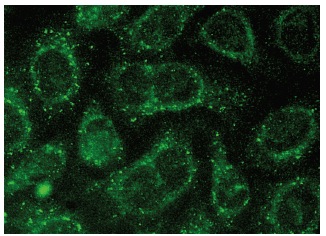 AQP5 (H-200): sc-28628. Immunofluorescence staining of methanol-fixed HeLa cells showing membrane and cytoplasmic localization.