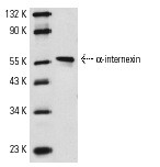 α-internexin (N-19): sc-7571. Western blot analysis of α-internexin expression in IMR-32 whole cell lysate.