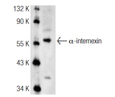 α-internexin (N-19): sc-7571. Western blot analysis of α-internexin expression in IMR-32 whole cell lysate.