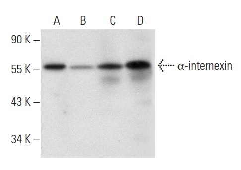 α-internexin (N-19): sc-7571. Western blot analysis of α-internexin expression in SH-SY5Y (A) and Y79 (B) whole cell lysates and human brain (C) and human spinal cord (D) tissue extracts.