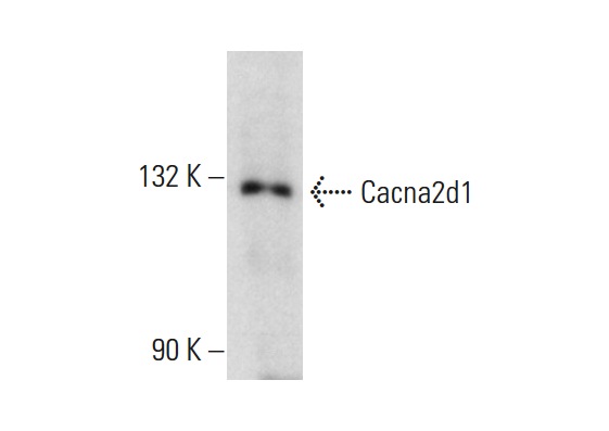 Cacna2d1 (E-10): sc-271697. Western blot analysis of Cacna2d1 expression in HeLa whole cell lysate.