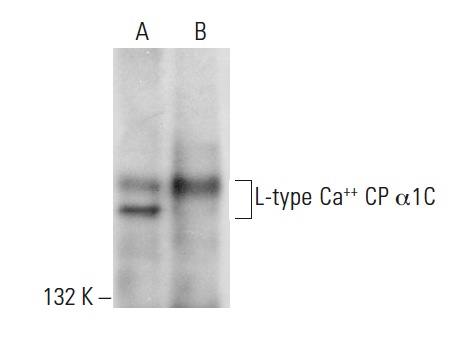 L-type Ca<sup>++</sup> CP α1C (D-6): sc-398433. Western blot analysis of L-type C<sup>a++ </sup>CP α1C expression in CCD-1064Sk whole cell lysate (A) and human heart tissue extract (B).