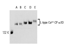 L-type Ca<sup>++</sup> CP α1D (E-19): sc-32072. Western blot analysis of L-type Ca<sup>++</sup> CP α1D expression in L6 (A), C6 (B), IMR-32 (C), SK-N-SH (D) and U-87 MG (E) whole cell lysates.