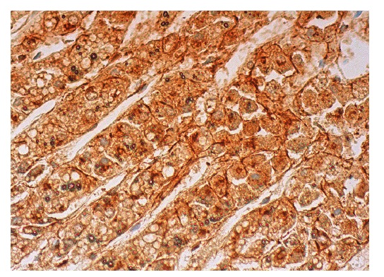 L-type Cα<sup>++</sup> CP α1D (C-20): sc-16251. Immunoperoxidase staining of formalin fixed, paraffin-embedded human adrenal gland tissue showing membrane and cytoplasmic staining of glandular cells.