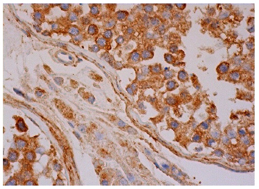 L-type Ca<sup>++ </sup>CP α1D (F-20): sc-32070. Immunoperoxi-dase staining of formalin fixed, paraffin-embedded human testis tissue showing cytoplasmic and membrane staining of cells in seminiferous ducts and cytoplasmic staining of Leydig cells.