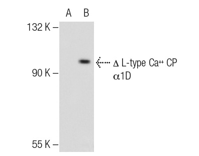 L-type Ca<sup>++</sup> CP α1D (H-20): sc-32071. Western blot analysis of L-type Ca<sup>++</sup> CP α1D expression in non-transfected: sc-117752 (A) and truncated mouse L-type Ca<sup>++</sup> CP α1D transfected: sc-121266 (B) 293T whole cell lysates.