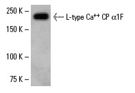 L-type Ca<sup>++</sup> CP α1F (H-160): sc-25688. Western blot analysis of L-type Ca<sup>++</sup> CP α1F expression in Y79 whole cell lysate.