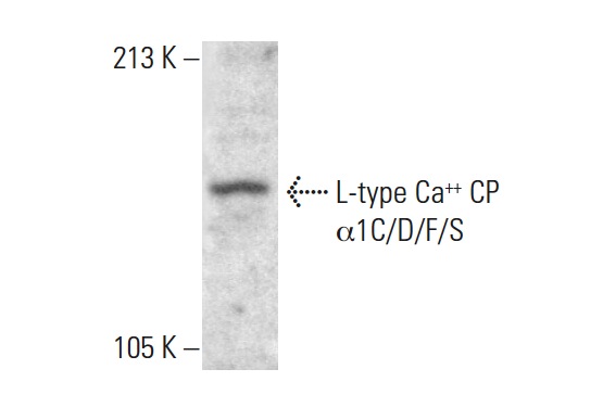 L-type Ca<sup>++</sup> CP α1C/D/F/S (D-19): sc-103588. Western blot analysis of L-type Ca<sup>++</sup> CP α1C/D/F/S expression in IMR-32 whole cell lysate.