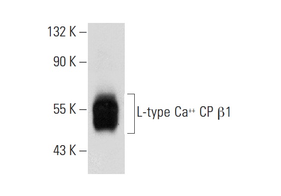 L-type Ca<sup>++</sup> CP β1 (D-15): sc-32079. Western blot analysis of L-type Ca<sup>++</sup> CP β1 expression in rat skeletal muscle tissue extract.