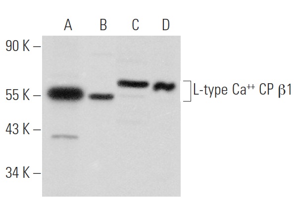 L-type Ca++ CP 1 (N-16): sc-32077. Western blot analysis of L-type Ca++ CP 1 expression in mouse brain tissue extract (A) and Jurkat (B), Raji (C) and IMR-32 (D) whole cell lysates.