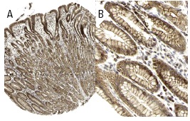 L-type Ca<sup>++</sup> CP β1A (H-50): sc-25689. Immunoperoxidase staining of formalin fixed, paraffin-embedded human stomach tissue showing cytoplasmic and membrane staining of glandular cells at low (A) and high (B) magnification. Kindly provided by The Swedish Human Protein Atlas (HPA) program.