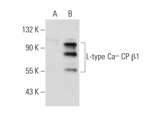 L-type Ca<sup>++</sup> CP β1 (Y-2D68): sc-134377. Western blot analysis of L-type Ca<sup>++</sup> CP β1 expression in non-transfected: sc-117752 (A) and human L-type Ca<sup>++</sup> CP β1 transfected: sc-176607 (B) 293T whole cell lysates.
