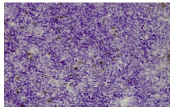 CLIC3 (405): sc-81872. Immunoperoxidase staining of formalin-fixed, paraffin-embedded human placenta tissue showing cytoplasmic localization.