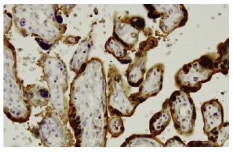 CLIC3 (405): sc-81872. Immunoperoxidase staining of formalin-fixed, paraffin-embedded human placenta tissue showing nuclear and cytoplasmic localization.