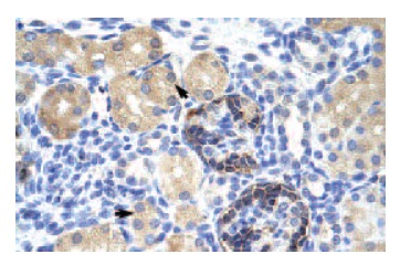 CLIC5 (B-23): sc-133468. Immunoperoxidase staining of formalin-fixed, paraffin-embedded human kidney tissue showing cytoplasmic localization.