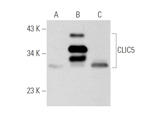 CLIC5 (B-23): sc-133468. Western blot analysis of CLIC5 expression in non-transfected 293T: sc-117752 (A), human CLIC5 transfected 293T: sc-173628 (B) and JAR (C) whole cell lysates.
