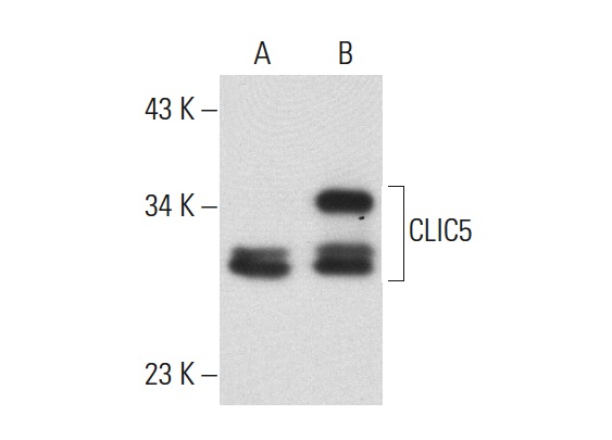 CLIC5 (B-23): sc-133468. Western blot analysis of CLIC5 expression in non-transfected: sc-117752 (A) and human CLIC5 transfected: sc-173684 (B) 293T whole cell lysates.