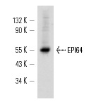 EPI64 (M-120): sc-33617. Western blot analysis of EPI64 expression in mouse embryo tissue extract.