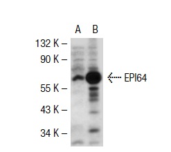 EPI64 (M-120): sc-33617. Western blot analysis of EPI64 expression in non-transfected: sc-117752 (A) and human EPI64 transfected: sc-112711 (B) 293T whole cell lysates.