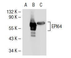 EPI64 (M-120): sc-33617. Western blot analysis of EPI64 expression in non-transfected: sc-117752 (A) and mouse EPI64 transfected: sc-125304 (B) 293T whole cell lysates and mouse embryo tissue extract (C).