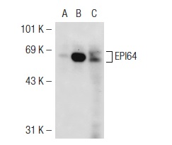 EPI64 (M-120): sc-33617. Western blot analysis of EPI64 expression in non-transfected: sc-117752 (A) and human EPI64 transfected: sc-112839 (B) 293T whole cell lysates and mouse embryo tissue extract (C).