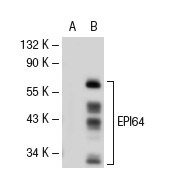 EPI64 (N-20): sc-18280. Western blot analysis of EPI64 expression in non-transfected: sc-117752 (A) and mouse EPI64 transfected: sc-125303 (B) 293T whole cell lysates.