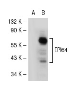 EPI64 (N-20): sc-18280. Western blot analysis of EPI64 expression in non-transfected: sc-117752 (A) and mouse EPI64 transfected: sc-125304 (B) 293T whole cell lysates.