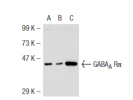 GABA<sub>A</sub> Rπ (H-115): sc-25708. Western blot analysis of GABA<sub>A</sub> Rπ expression in non-transfected 293T: sc-117752 (A), mouse GABA<sub>A</sub> Rπ transfected 293T: sc-125360 (B) and LNCaP (C) whole cell lysates.