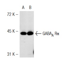GABA<sub>A</sub> Rπ (H-115): sc-25708. Western blot analysis of GABA<sub>A</sub> Rπ expression in non-transfected: sc-117752 (A) and mouse GABA<sub>A</sub> Rπ transfected: sc-125362 (B) 293T whole cell lysates.