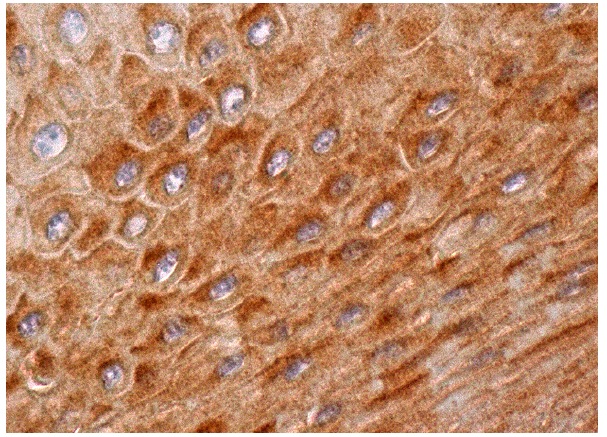GABA<sub>A</sub> Rπ (H-115): sc-25708. Immunoperoxidase staining of formalin fixed, paraffin-embedded human oral mucosa tissue showing cytoplasmic staining of squamous epithelial cells.