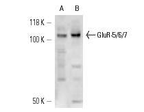 GluR-5/6/7 (M-270): sc-28797. Western blot analysis of GluR-5/6/7 expression in EOC 20 whole cell lysate (A) and rat brain tissue extract (B).
