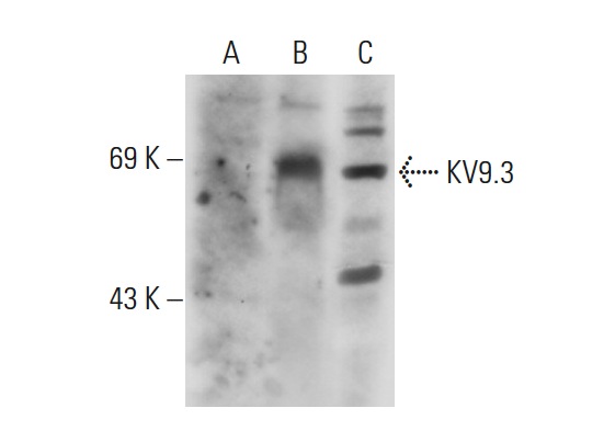KV9.3 (H-81): sc-134865. Western blot analysis of KV9.3 expression in non-transfected 293: sc-110760 (A), human KV9.3 transfected 293: sc-158673 (B) and HISM (C) whole cell lysates.