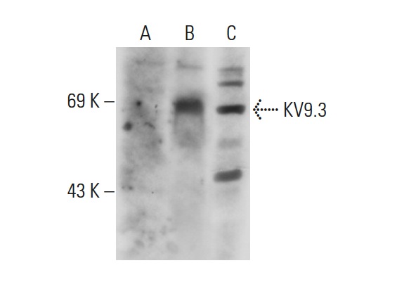 KV9.3 (H-81): sc-134865. Western blot analysis of KV9.3 expression in non-transfected 293T: sc-117752 (A), human KV9.3 transfected 293T: sc-158672 (B) and HISM (C) whole cell lysates.