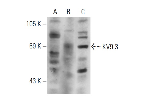 KV9.3 (H-81): sc-134865. Western blot analysis of KV9.3 expression in non-transfected 293T: sc-117752 (A), human KV9.3 transfected 293T: sc-159595 (B) and HISM (C) whole cell lysates.