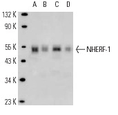 NHERF-1 (EBP-10): sc-51684. Western blot analysis of NHERF-1 expression in non-transfected: sc-110760 (A) and human NHERF-1 transfected: sc-110574 (B) 293 whole cell lysates.
