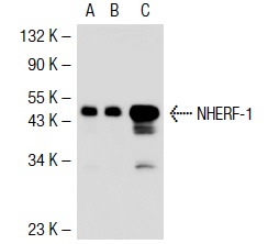 NHERF-1 (EBP-10): sc-51684. Western blot analysis of NHERF-1 expression in non-transfected 293T: sc-117752 (A), human NHERF-1 transfected 293T: sc-116473 (B) and JEG-3 (C) whole cell lysates.