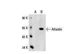 Atlastin (C-16): sc-49157. Western blot analysis of Atlastin expression in non-transfected: sc-110760 (A) and human Atlastin transfected: sc-111145 (B) 293 whole cell lysates.