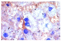PMCA1/4 (5F10): sc-20028. Immunoperoxidase staining of formalin-fixed, paraffin-embedded human liver tissue showing membrane and cytoplasmic staining