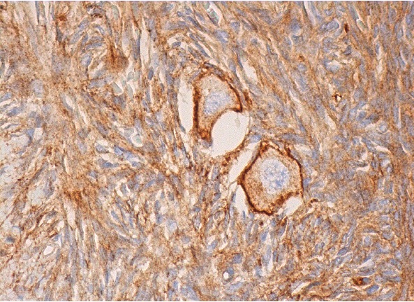PMCA1/4 (5F10): sc-20028. Immunoperoxidase staining of formalin fixed, paraffin-embedded human ovary tissue showing membrane and cytoplasmic staining of follicle cells and cytoplasmic staining of ovarian stroma cells.