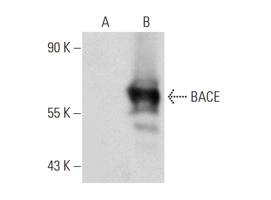 BACE (61-3E7): sc-33711. Western blot analysis of BACE expression in non-transfected: sc-117752 (A) and human BACE transfected: sc-159912 (B) 293T whole cell lysates.